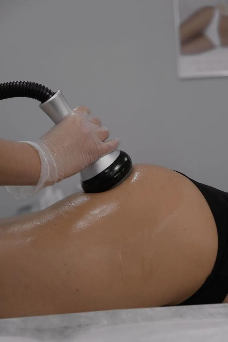 Skin Tightening