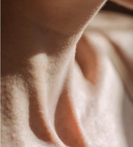 Close view of loose, lax skin