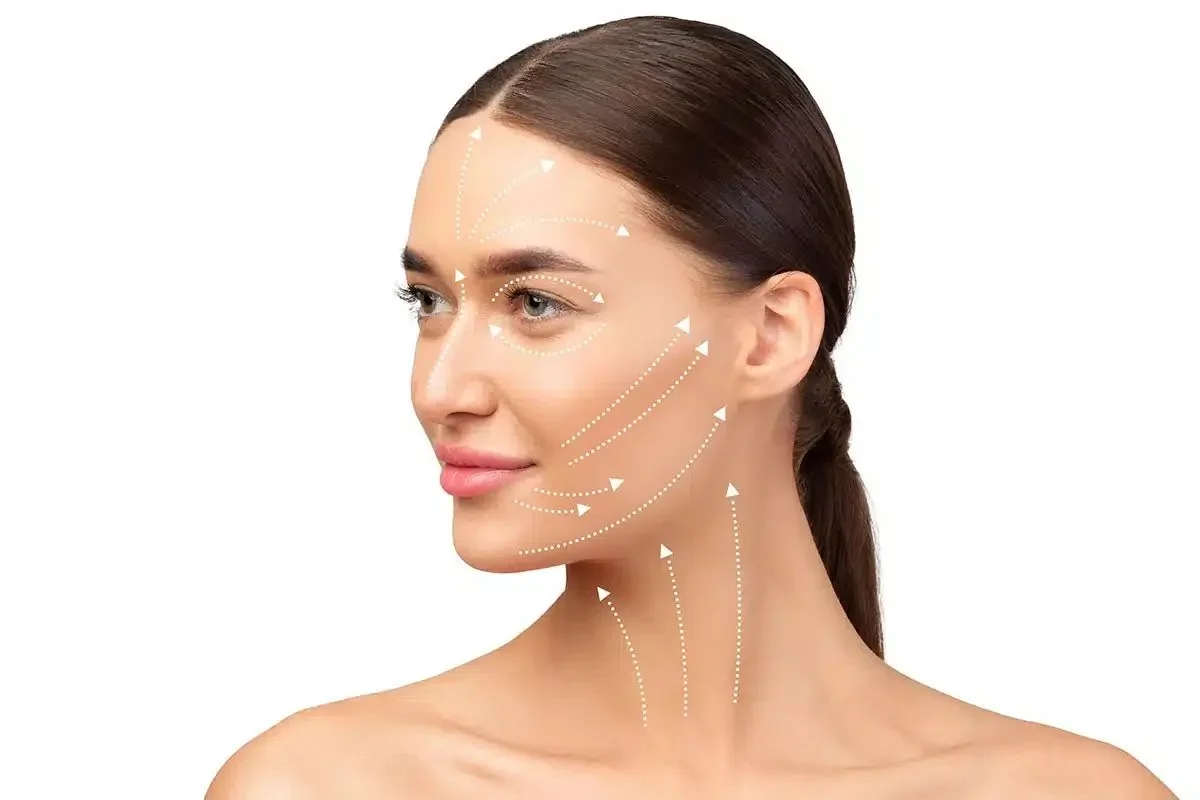 Lifting lines traced along the jawline, cheek and neck, the areas skin tightening treats