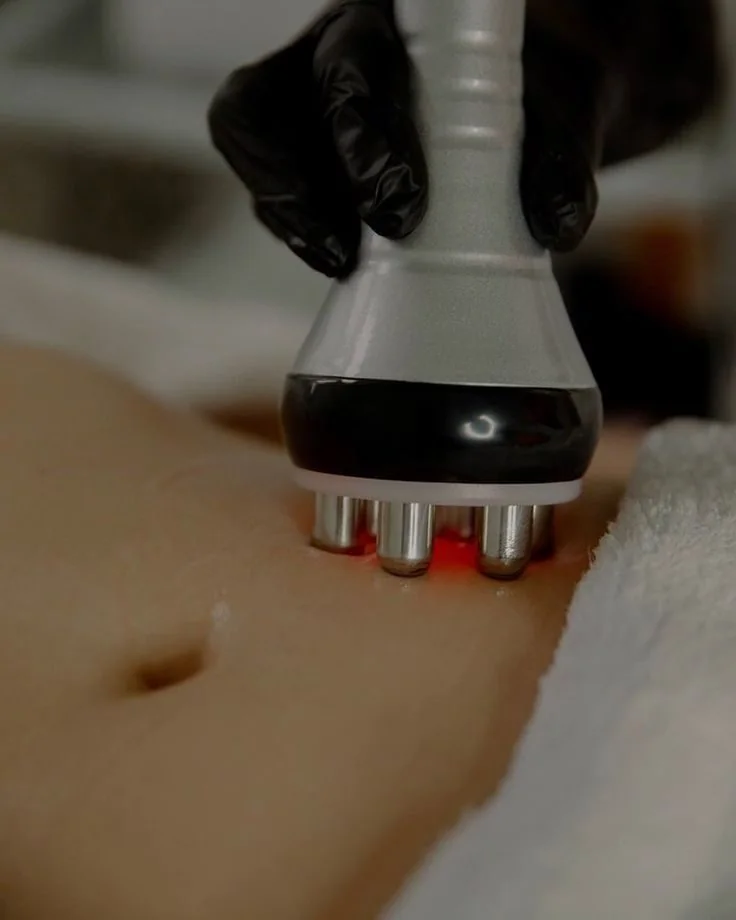 Laser Liposuction & Liposculpting